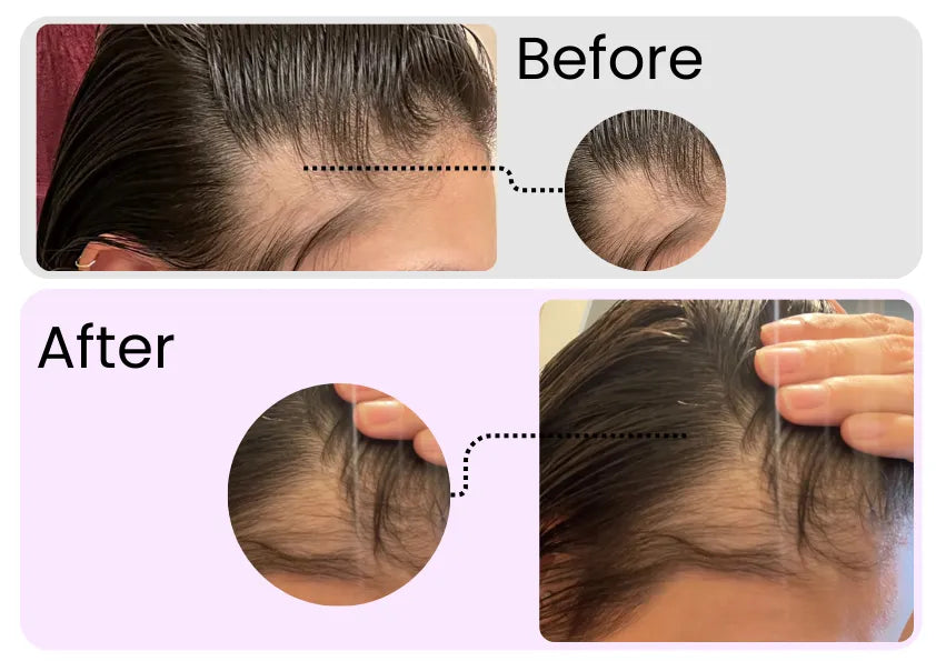 Rosemary Essential Oil – Organic Hair Growth & Scalp Therapy