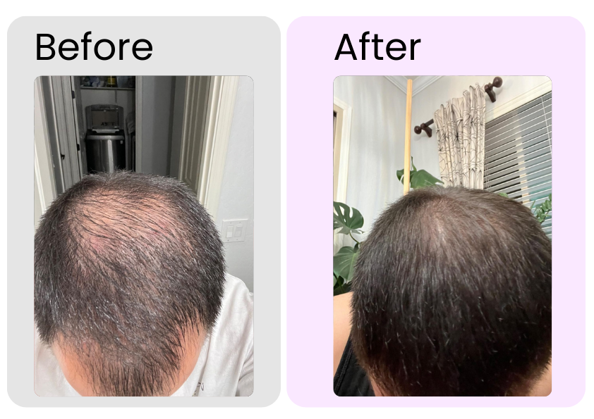 Rosemary Essential Oil – Organic Hair Growth & Scalp Therapy