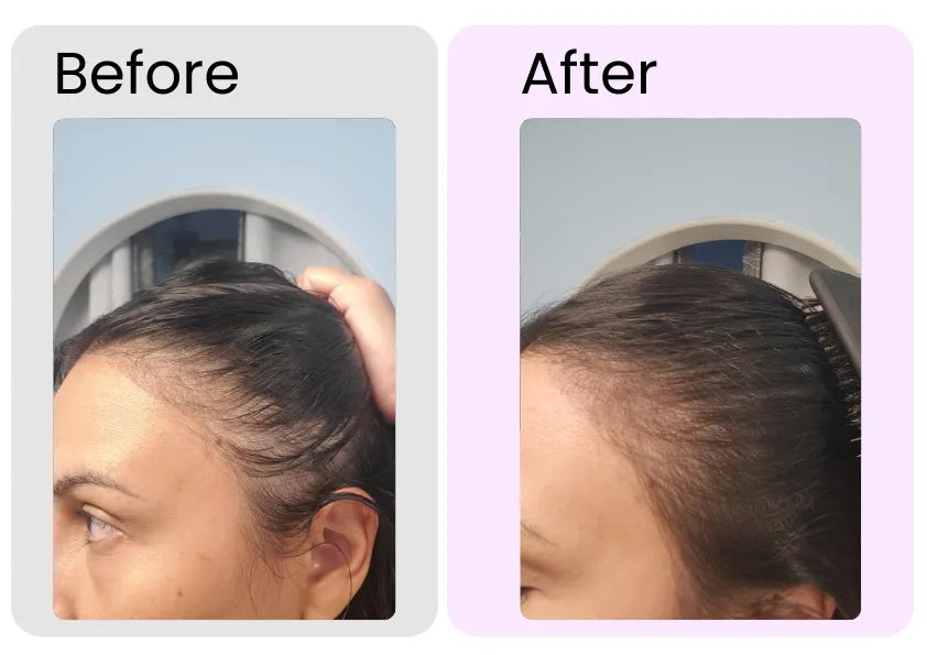 Rosemary Essential Oil – Organic Hair Growth & Scalp Therapy