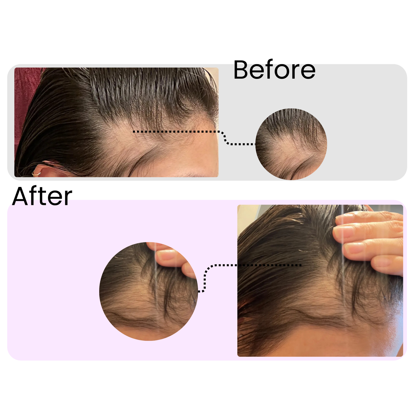 Rosemary Essential Oil – Organic Hair Growth & Scalp Therapy