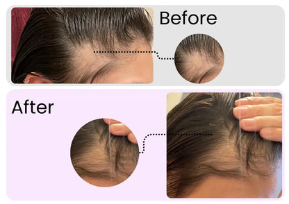 Rosemary Essential Oil – Organic Hair Growth & Scalp Therapy