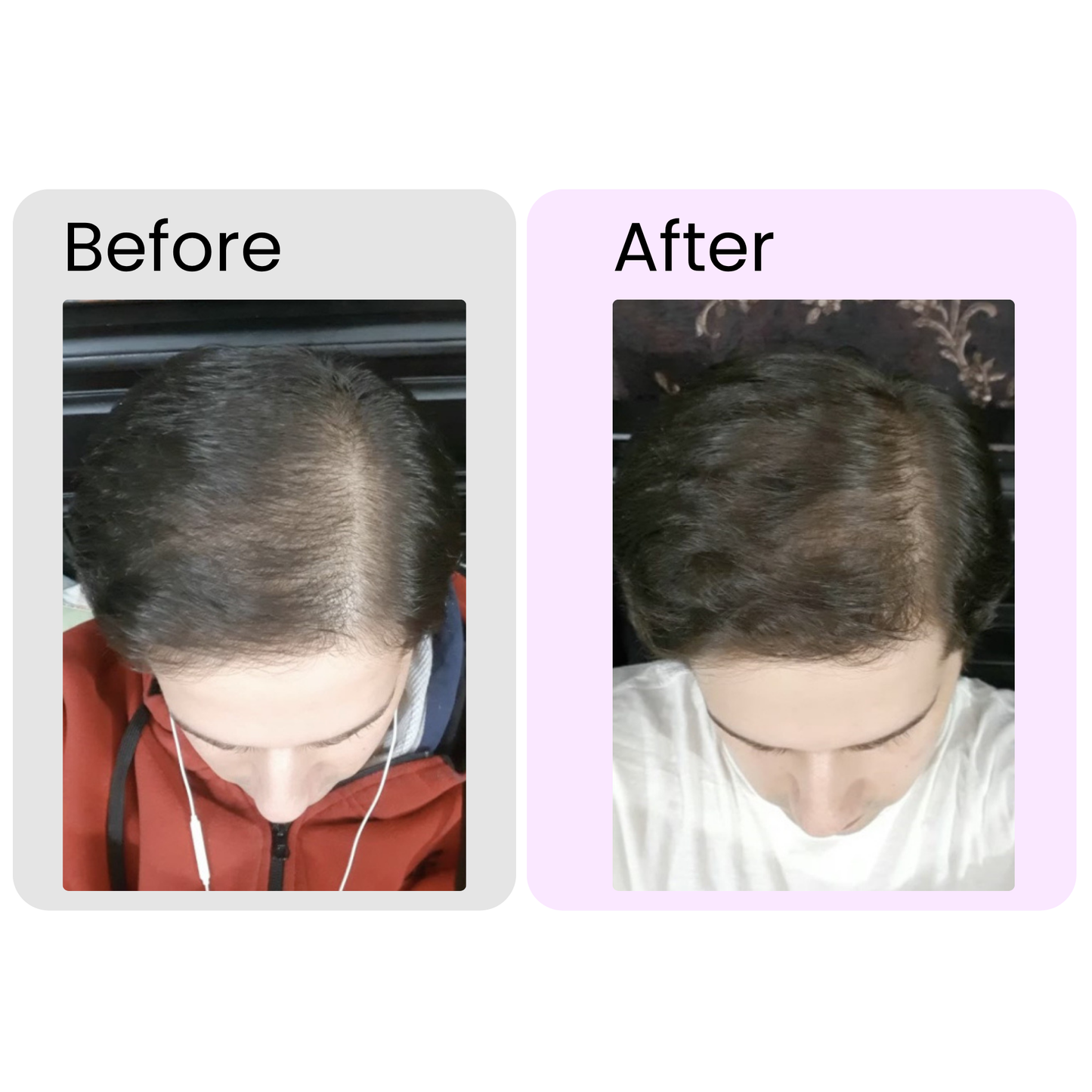 Rosemary Essential Oil – Organic Hair Growth & Scalp Therapy