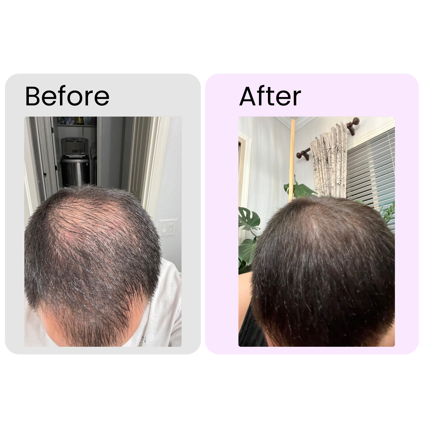 Rosemary Essential Oil – Organic Hair Growth & Scalp Therapy