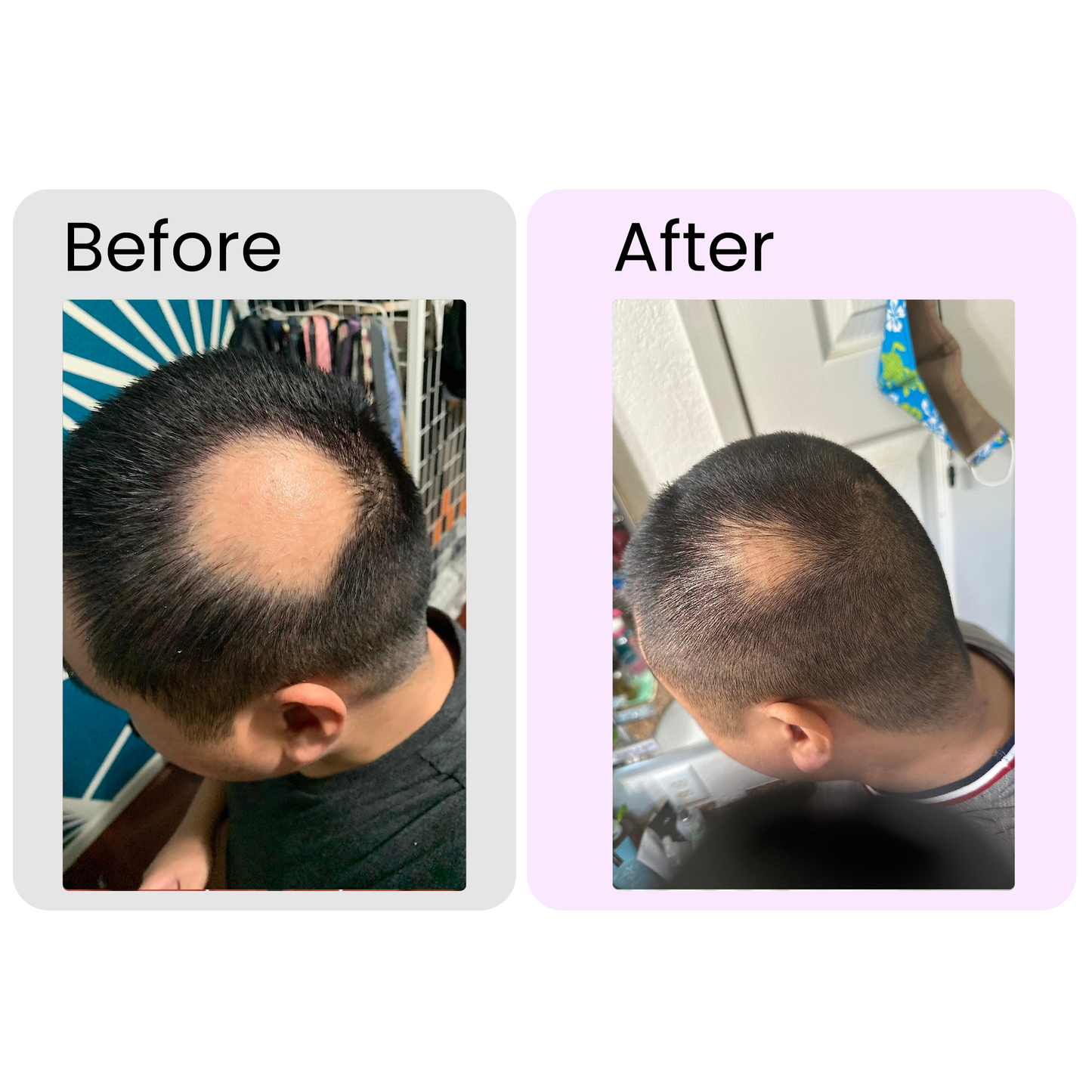 Rosemary Essential Oil – Organic Hair Growth & Scalp Therapy