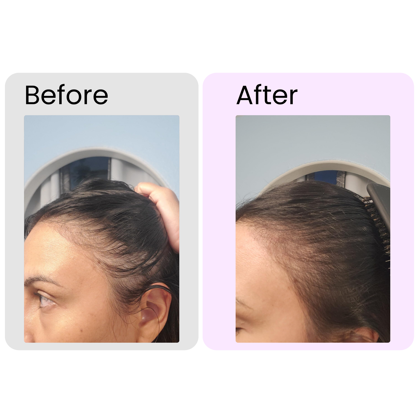 Rosemary Essential Oil – Organic Hair Growth & Scalp Therapy